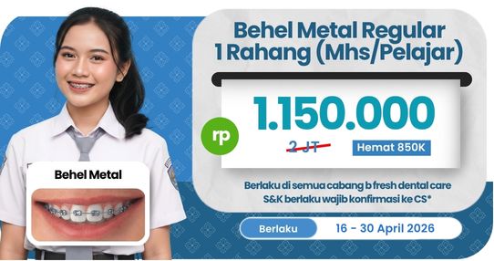 Behel Metal Regular (Pelajar)